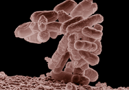 Bakteri e-coli